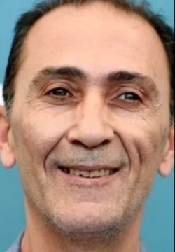 Сухейл Алдаббач